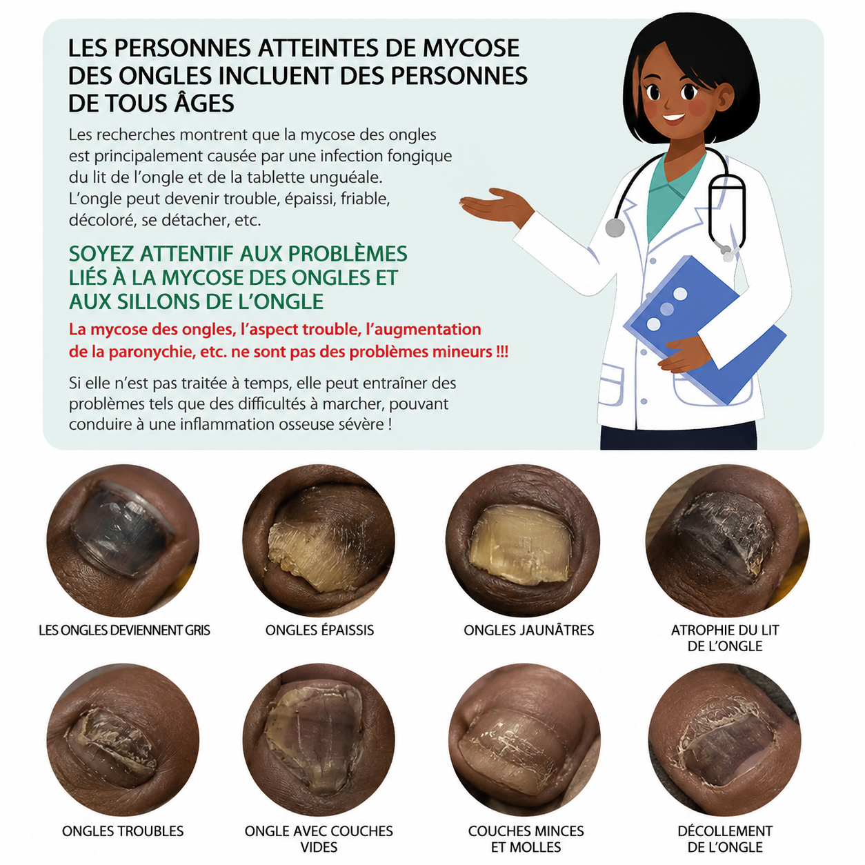 Serum anti-mycose pour Ongles-BN
