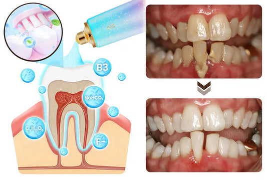 Dentifrice au Niacinamide - Souriez en toute confiance BODYARCEL