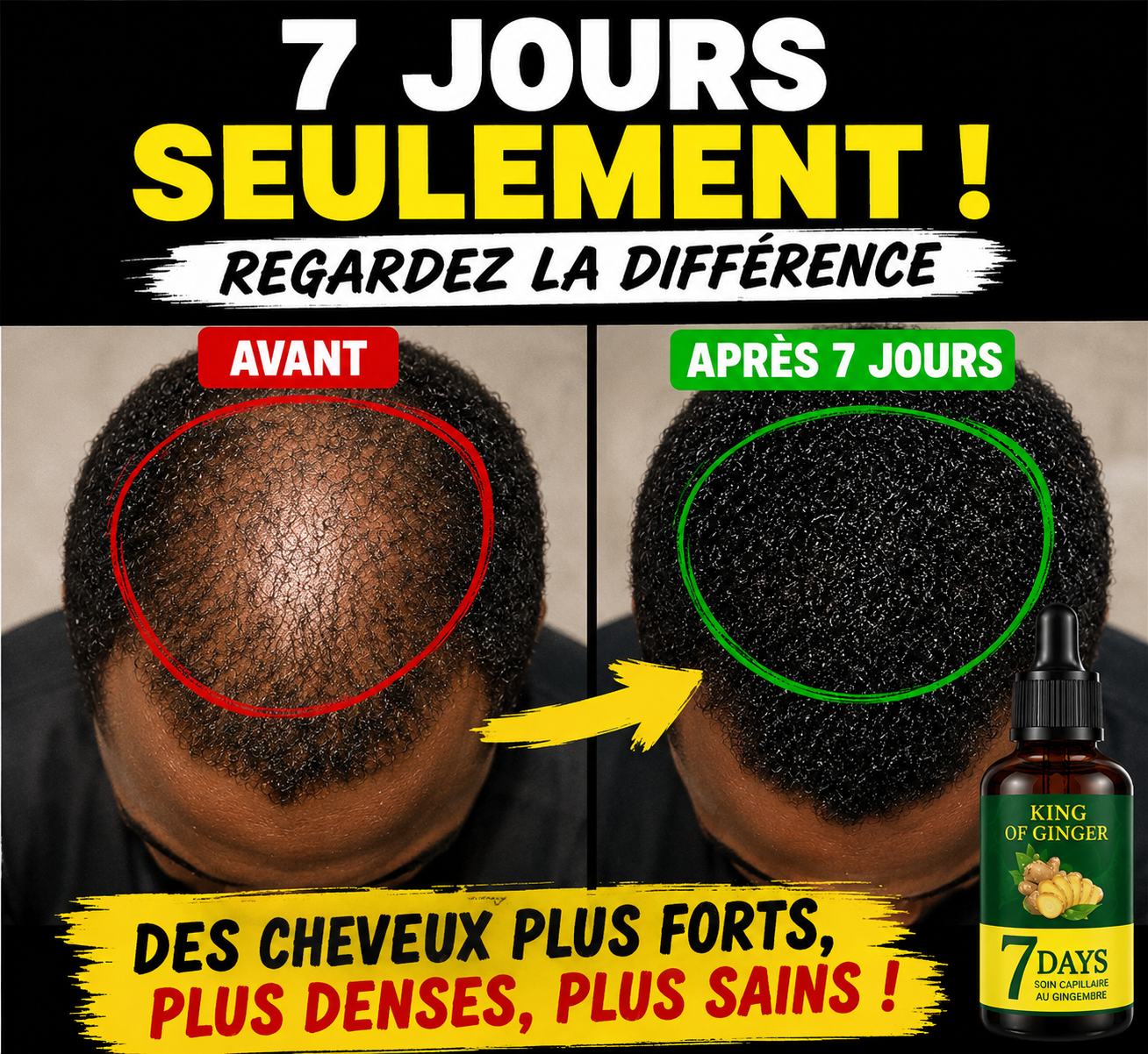Sérum de croissance des cheveux 7 jours