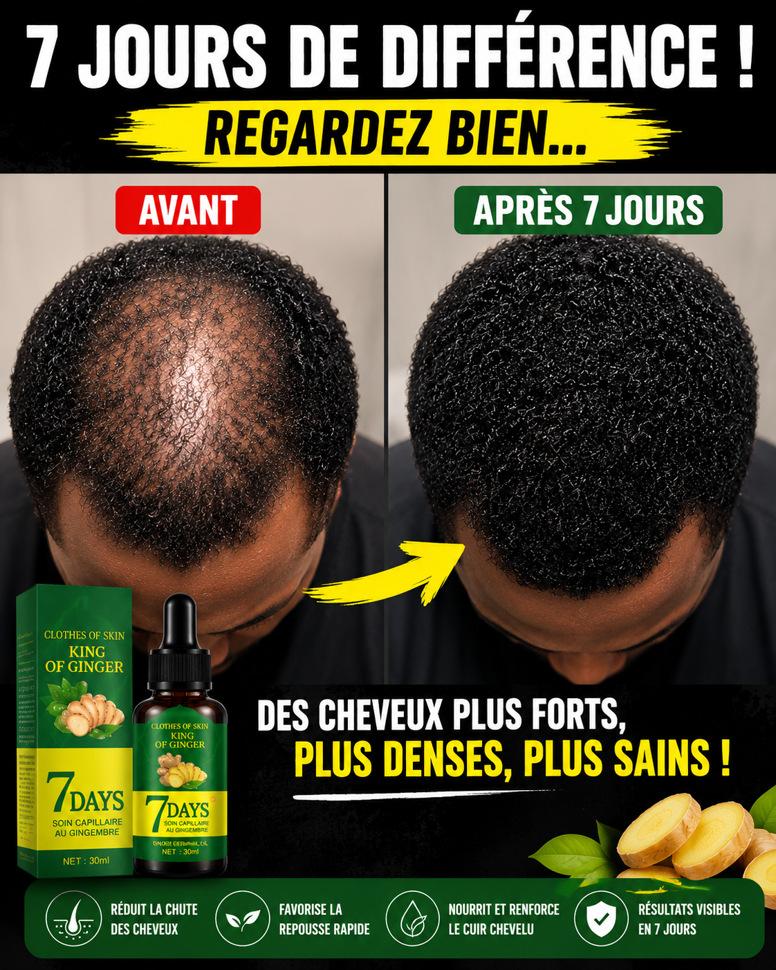 Sérum de croissance des cheveux 7 jours
