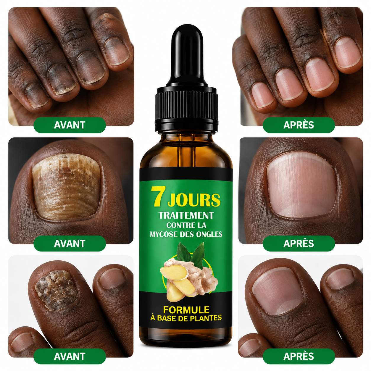 Serum anti-mycose pour Ongles-CG