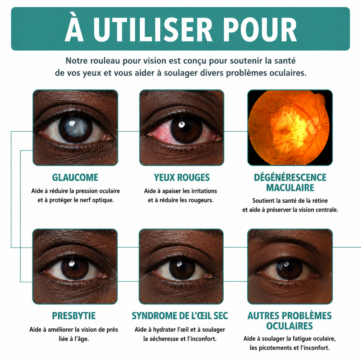 Rouleau d'Amélioration de la Vision (CFQ)