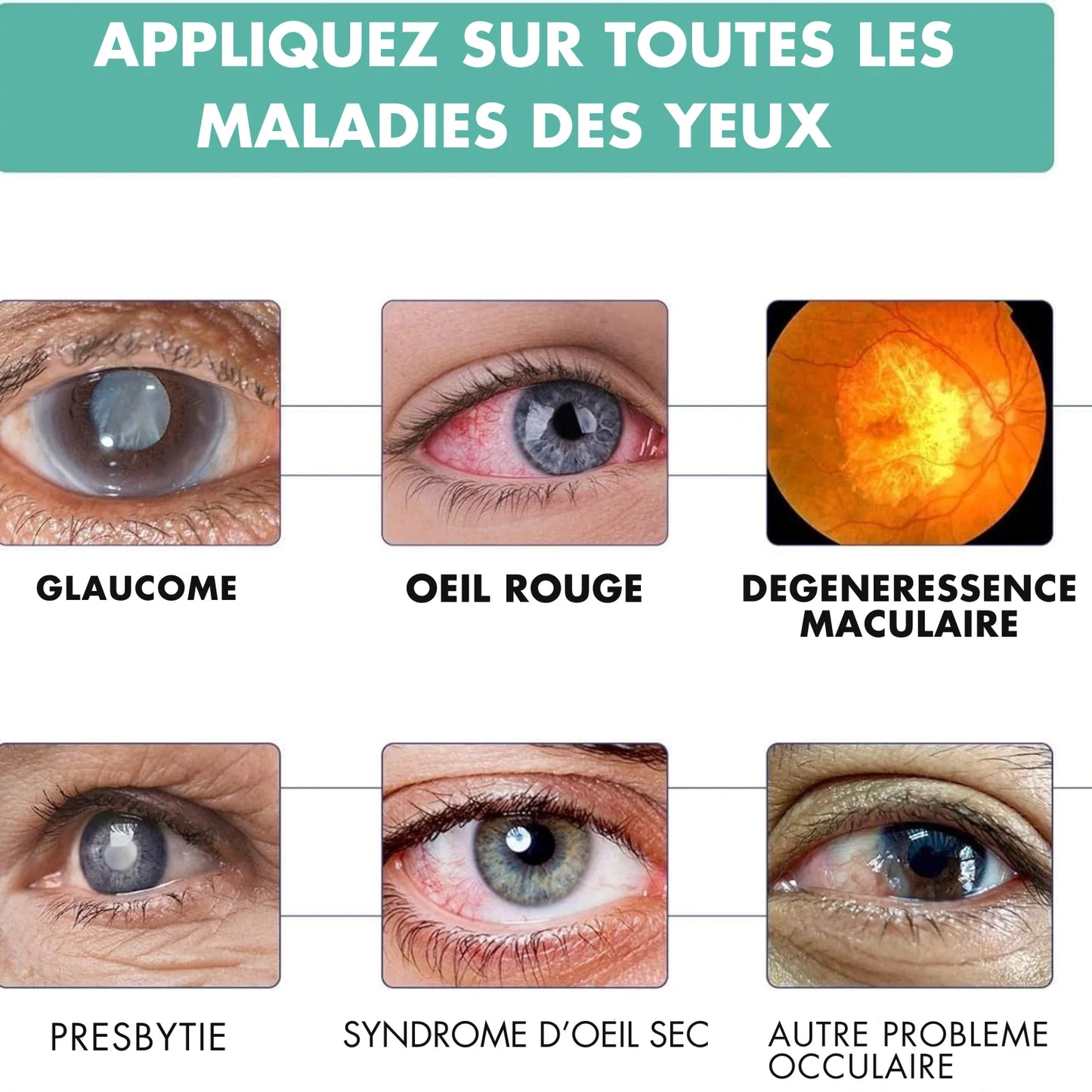 Rouleau d'Amélioration de la Vision – Soin Naturel pour Vos Yeux